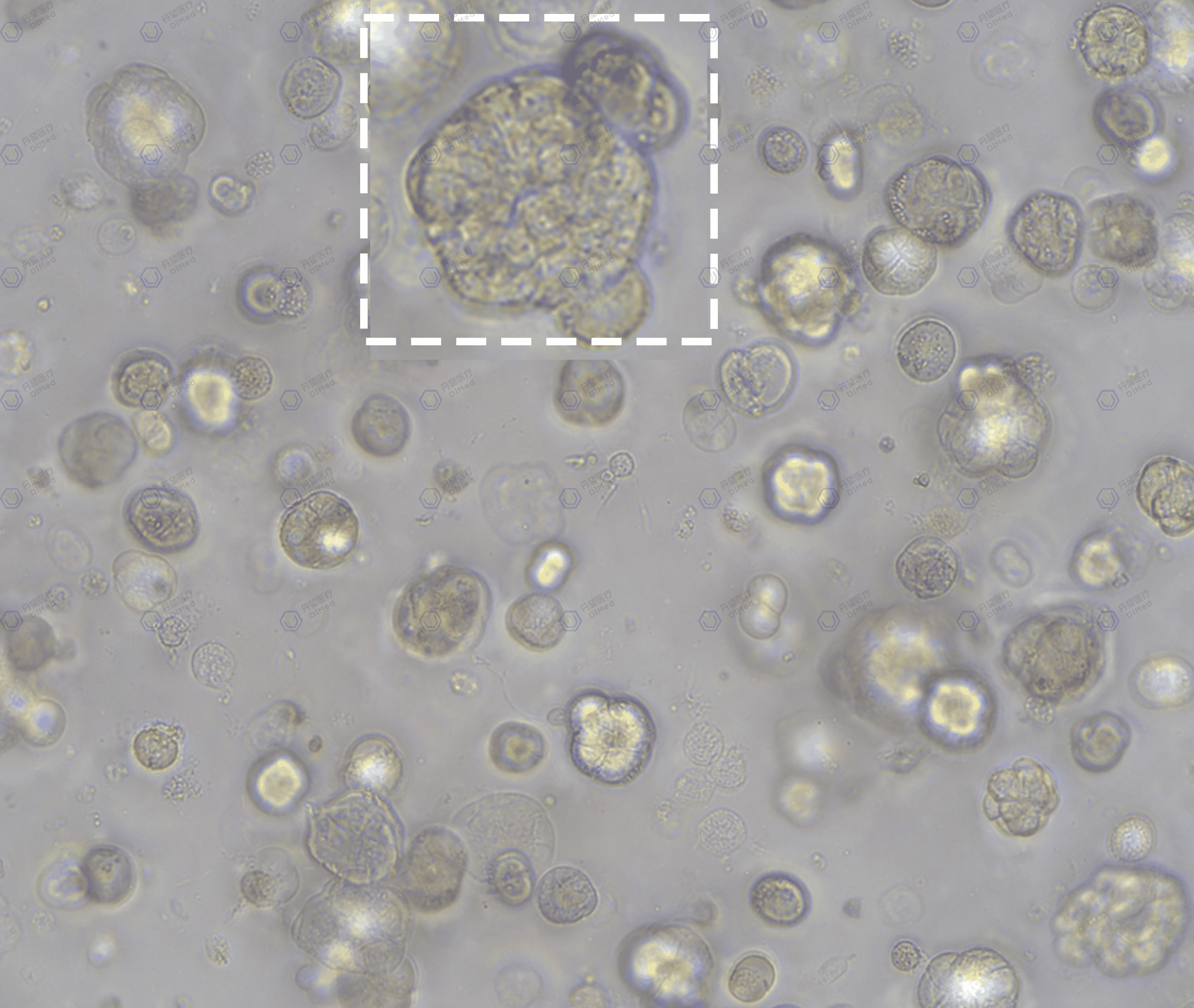 丹望医疗人肝类器官模型